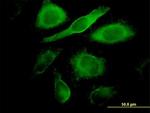 CDK4 Antibody in Immunocytochemistry (ICC/IF)