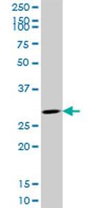 CDK4 Antibody in Western Blot (WB)