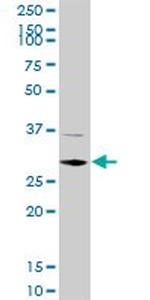 CDK4 Antibody in Western Blot (WB)