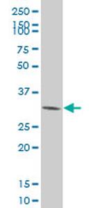 CDK4 Antibody in Western Blot (WB)