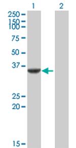 CDK5 Antibody in Western Blot (WB)