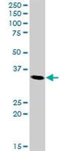 CDK5 Antibody in Western Blot (WB)