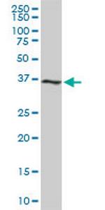 CDK6 Antibody in Western Blot (WB)