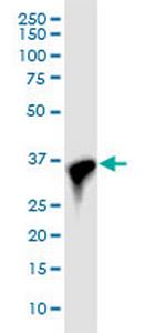 CDK6 Antibody in Western Blot (WB)