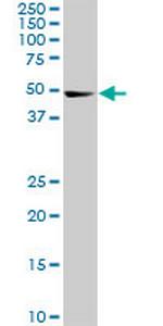 CDK8 Antibody in Western Blot (WB)