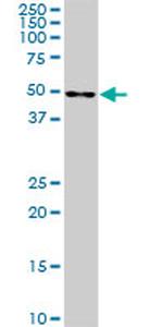 CDK8 Antibody in Western Blot (WB)