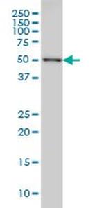 CDK8 Antibody in Western Blot (WB)