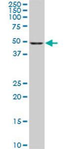 CDK8 Antibody in Western Blot (WB)