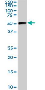 CDK8 Antibody in Western Blot (WB)