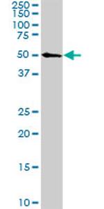 CDK8 Antibody in Western Blot (WB)