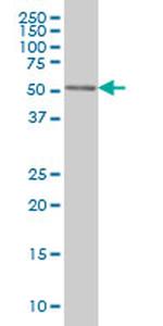 CDK8 Antibody in Western Blot (WB)