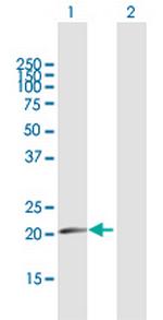 CDKN1A Antibody in Western Blot (WB)