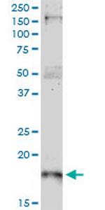 CDKN1A Antibody in Western Blot (WB)