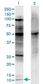 CDKN2A Antibody in Western Blot (WB)