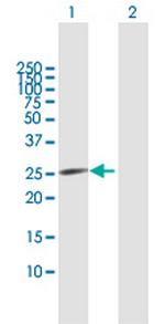 CDKN3 Antibody in Western Blot (WB)