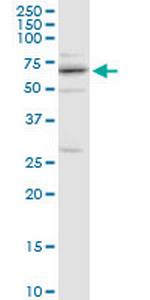 CENPB Antibody in Western Blot (WB)