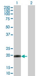 CETN1 Antibody in Western Blot (WB)