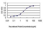 CETN1 Antibody in ELISA (ELISA)