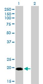 CETN1 Antibody in Western Blot (WB)