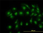 CFL1 Antibody in Immunocytochemistry (ICC/IF)