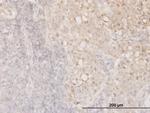 CFL1 Antibody in Immunohistochemistry (Paraffin) (IHC (P))