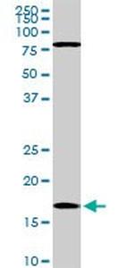 CFL1 Antibody in Western Blot (WB)