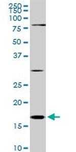 CFL1 Antibody in Western Blot (WB)