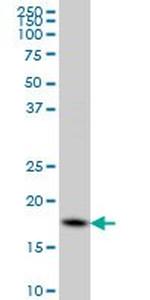 CFL1 Antibody in Western Blot (WB)