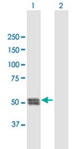 CTSC Antibody in Western Blot (WB)