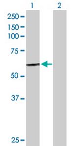 CTSC Antibody in Western Blot (WB)