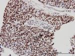 CHD4 Antibody in Immunohistochemistry (Paraffin) (IHC (P))