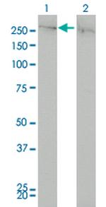 CHD4 Antibody in Western Blot (WB)