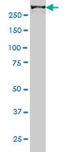 CHD4 Antibody in Western Blot (WB)