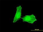 CHEK1 Antibody in Immunocytochemistry (ICC/IF)