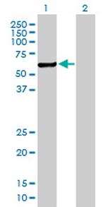 CHKA Antibody in Western Blot (WB)