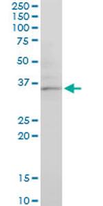 CHN1 Antibody in Western Blot (WB)