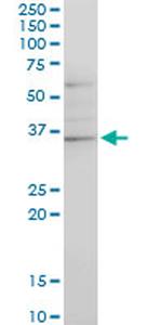 CHN1 Antibody in Western Blot (WB)