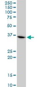 CHN1 Antibody in Western Blot (WB)