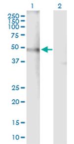 CHRNA4 Antibody in Western Blot (WB)