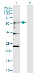 CHRNA4 Antibody in Western Blot (WB)