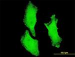 CHUK Antibody in Immunocytochemistry (ICC/IF)