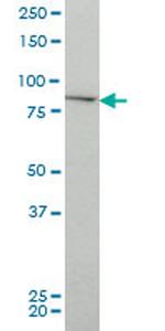 CHUK Antibody in Western Blot (WB)