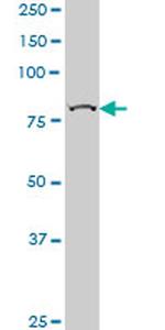 CHUK Antibody in Western Blot (WB)