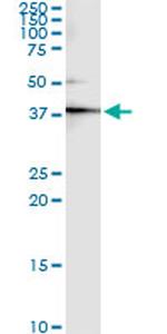 CKM Antibody in Immunoprecipitation (IP)