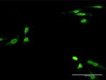 CKM Antibody in Immunocytochemistry (ICC/IF)