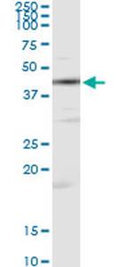 CKM Antibody in Immunoprecipitation (IP)