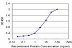 CKMT1B Antibody in ELISA (ELISA)