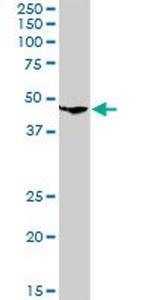 CLN3 Antibody in Western Blot (WB)