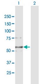 COL6A2 Antibody in Western Blot (WB)