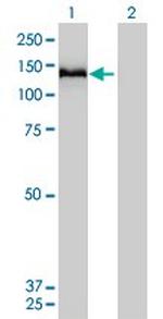 COL6A2 Antibody in Western Blot (WB)